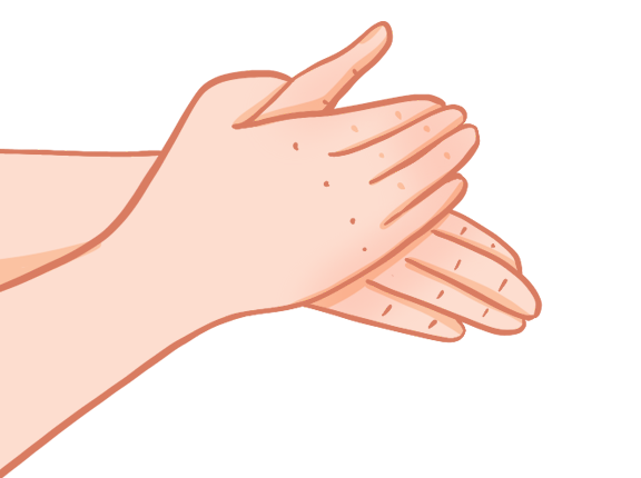 免洗洗手液的好處和壞處，使用時(shí)要注意什么，用了粘手咋回事